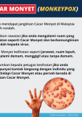 Cacar Monyet (MonkeyPox)